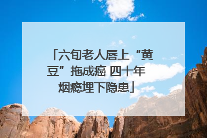 六旬老人唇上“黄豆”拖成癌 四十年烟瘾埋下隐患
